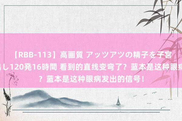 【RBB-113】高画質 アッツアツの精子を子宮に孕ませ中出し120発16時間 看到的直线变弯了？蓝本是这种眼病发出的信号！